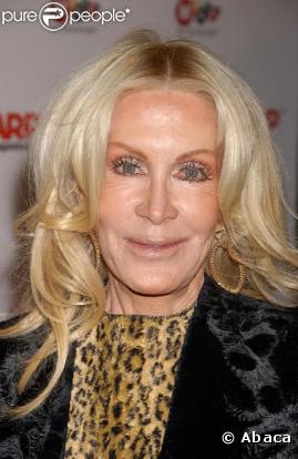 Joan Van Ark a, elle aussi, était choisie pour jouer dans Nip/Tuck. Pas étonnant avec une tête pareille ! a 65 ans, la comédienne fait vraiment peur à voir...