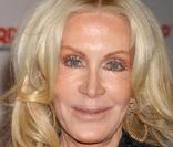 Joan Van Ark a, elle aussi, était choisie pour jouer dans Nip/Tuck. Pas étonnant avec une tête pareille ! a 65 ans, la comédienne fait vraiment peur à voir... 