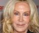Joan Van Ark a, elle aussi, était choisie pour jouer dans Nip/Tuck. Pas étonnant avec une tête pareille ! a 65 ans, la comédienne fait vraiment peur à voir...