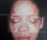 Rihanna le visage marqué juste après son altercation avec Chris Brown du 7 février 2009