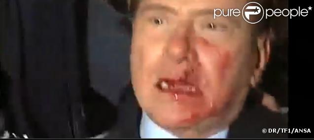 Silvio Berlusconi le visage en sang agressé le 13 décembre lors  d'un meeting !