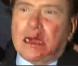 Silvio Berlusconi le visage en sang agressé le 13 décembre lors  d'un meeting !