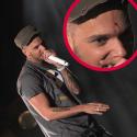 PHOTOS : M. Pokora, blessé lors du concert au Club Med World ! 