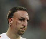 Franck Ribéry