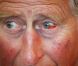 Mercredi 27 avril 2011, le prince Charles, qui avait un petit problème à l'oeil, observait les rénovations de Dumfries House, en Ecosse, qu'il a rachetée en 2007 pour l'ouvrir au public.