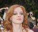 PHOTOS : Rose McGowan de 'Charmed', jamais sans mon attelle !