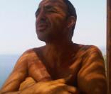Nikos Aliagas victime d'un moustique