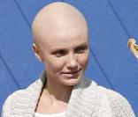 Cameron Diaz sans ses cheveux sur le tournage de My Sister's Keeper