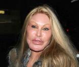 Jocelyn Wildenstein