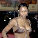 La chanteuse Sonique opérée d'un cancer du sein...
