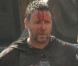 La star Russell Crowe le visage en sang... sur le tournage de 