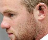 Wayne Rooney et son oreille déchirée !