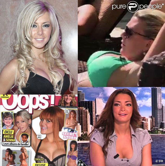 Les candidates de Secret Story sont souvent tentées par la chirurgie esthétique...