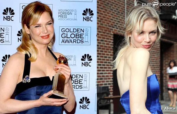 Renée Zellweger : L'actrice n'en finit plus de maigrir... Regardez sa métamorphose !