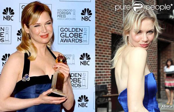 Renée Zellweger : L'actrice n'en finit plus de maigrir... Regardez sa métamorphose !