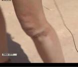 Elodie Gossuin, après sa chute en direct pendant le Dakar