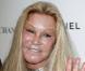 Jocelyn Wildenstein a dépensé 3 millions d'euros en chirurgie esthétique pour... ressembler à un chat ! Incroyable !