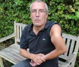 Cet homme s'est cassé le bras lors d'un accident de la route il y a 10 mois. Il vit ainsi depuis.
