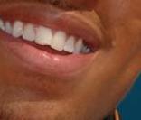 Chris Brown