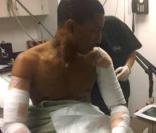Pharrell Williams en train de se faire enlever ses tatouages au laser !