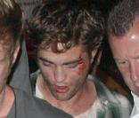 Robert Pattinson, le visage en sang sur le tournage du film Remember Me, à New York.