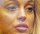Lindsay Lohan et ses nouvelles lèvres...