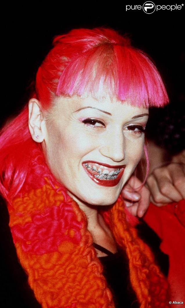 C'est sûr, l'appareil dentaire donne un peu des allures de Terminator à la pauvre Gwen Stefani... Mais il faut souffrir pour être belle ! Aujourd'hui la chanteuse des No Doubt peut de nouveau sourire à pleines dents ! 