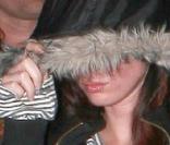 La très belle Megan Fox s'est fait refaire les lèvres, c'est pas beau...