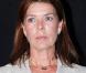 Caroline de Hanovre, pendant que son frère Albert est de mariage avec Charlene, poursuit son combat...