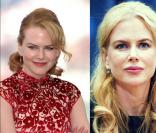 Nicole Kidman a-t-elle fait gonfler ses lèvres ?