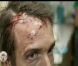 Accident de Stéphane Rotenberg dans Pékin Express - Le Passager Mystère le mercredi 16 mai 2012 sur M6