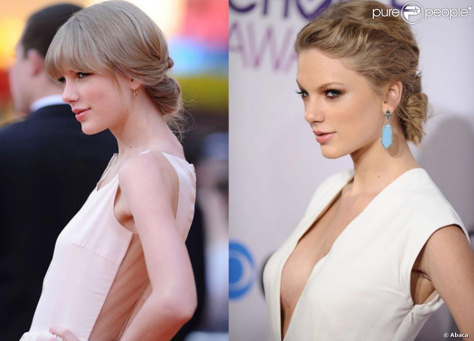 Taylor Swift avant et après chirurgie esthétique