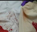 Le caleçon que portait Johnny Knoxville au moment de son accident