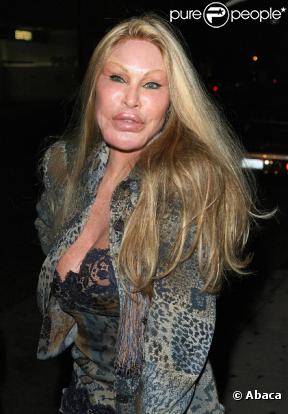 509892-jocelyn-wildenstein-0x414-3.jpg