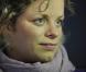Kim Clijsters, déjà en convalescence, s'est blessée au mariage d'un membre de sa famille, en avril 2011...