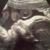 L'échographie du petit Ulises, le bébé de Shakira et Gerard Piqué que ce dernier a posté sur Twitter, le 6 décembre 2012.