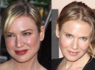 Renée Zellweger, Botox et chirurgie ? Son visage transformé suscite la rumeur