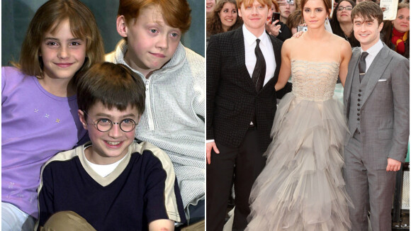 Harry, Ron, Hermione... Les stars d'Harry Potter ont bien changé !