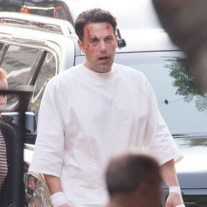 Ben Affleck le visage amoché sur le tournage de 'Live By Night' à Los Angeles, le 8 décembre 2015