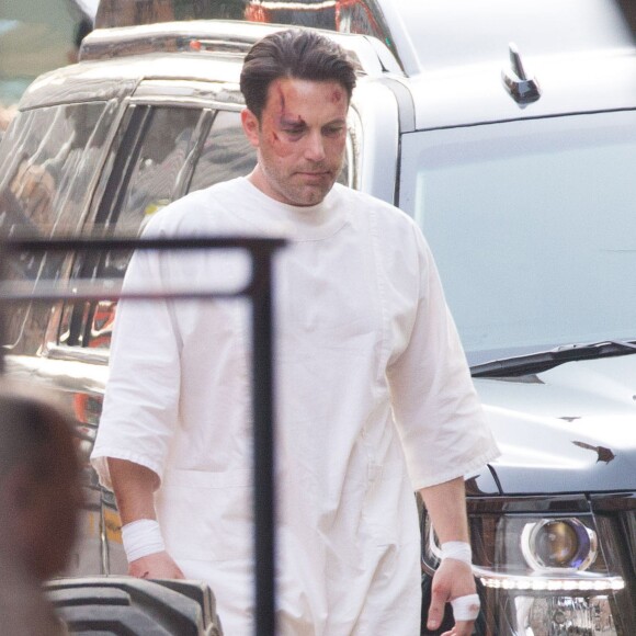 Ben Affleck le visage amoché sur le tournage de 'Live By Night' à Los Angeles, le 8 décembre 2015