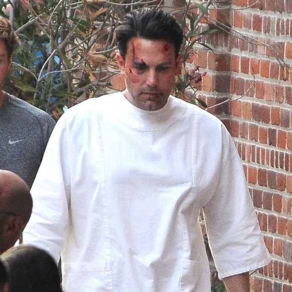 Ben Affleck le visage amoché sur le tournage de 'Live By Night' à Los Angeles, le 8 décembre 2015
