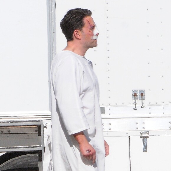 Exclusif - Ben Affleck, le nez cassé sur le tournage de 'Live By Night' à Los Angeles, le 8 décembre 2015.