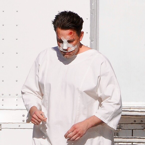 Exclusif - Ben Affleck, le nez cassé sur le tournage de 'Live By Night' à Los Angeles, le 8 décembre 2015.