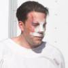Exclusif - Ben Affleck, le nez cassé sur le tournage de 'Live By Night' à Los Angeles, le 8 décembre 2015.