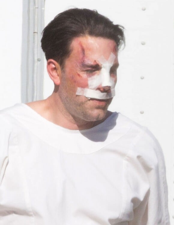 Exclusif - Ben Affleck, le nez cassé sur le tournage de 'Live By Night' à Los Angeles, le 8 décembre 2015.