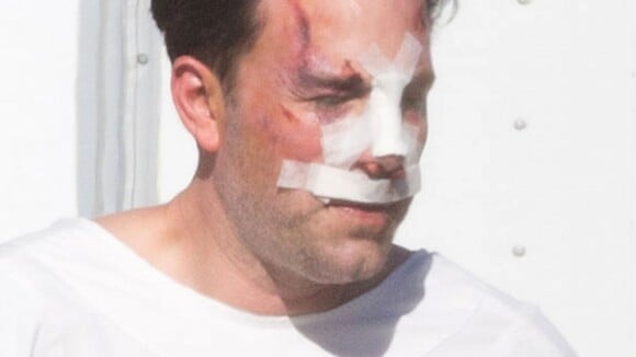 Ben Affleck, amoché et le nez cassé, dévoile son imposant (et vrai) tatouage