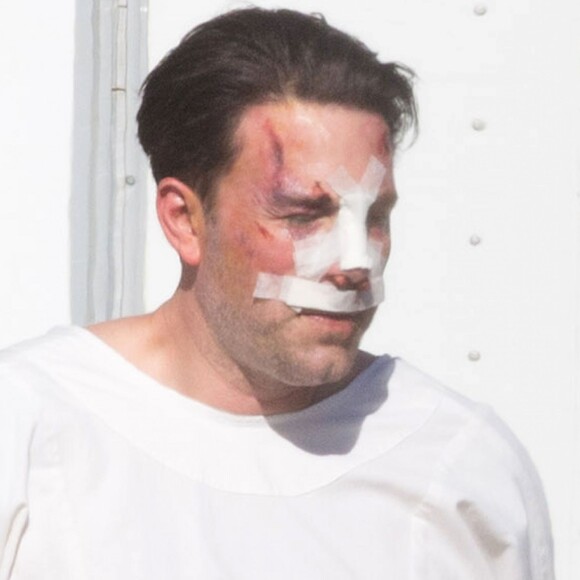 Exclusif - Ben Affleck, le nez cassé sur le tournage de 'Live By Night' à Los Angeles, le 8 décembre 2015.