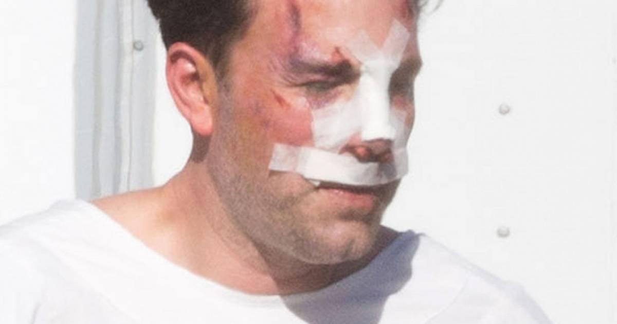 Ben Affleck Amoche Et Le Nez Casse Devoile Son Imposant Et Vrai Tatouage Purepeople