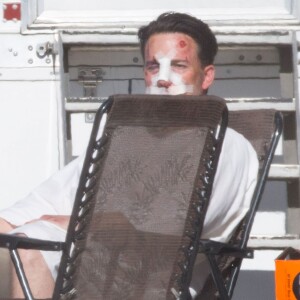 Exclusif - Ben Affleck, le nez cassé sur le tournage de 'Live By Night' à Los Angeles, le 8 décembre 2015.