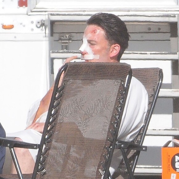 Exclusif - Ben Affleck, le nez cassé sur le tournage de 'Live By Night' à Los Angeles, le 8 décembre 2015.
